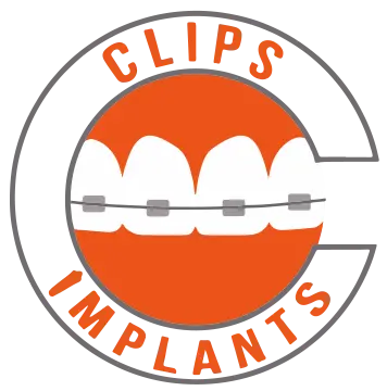 Clips Dental
